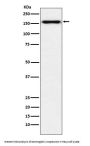 Anti-Desmoglein 2 Monoclonal Antibody
