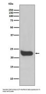 Anti-Interferon beta Rabbit Monoclonal Antibody