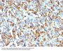 Anti-Factor XIIIa (Coagulation Factor XIIIA Chain) Monoclonal Antibody