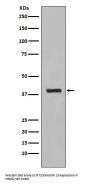 Anti-Cytokeratin 19 KRT19 Rabbit Monoclonal Antibody