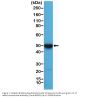 Anti-Cytokeratin 17 (CK-17) KRT19 Rabbit Monoclonal Antibody, Clone#RM351