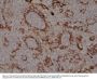 Anti-Cytokeratin 17 (CK-17) KRT19 Rabbit Monoclonal Antibody, Clone#RM351