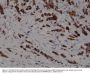 Anti-Cytokeratin 19 (CK-19) KRT19 Rabbit Monoclonal Antibody, Clone#RM364