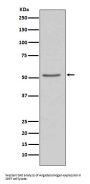 Anti-Angiotensinogen AGT Rabbit Monoclonal Antibody