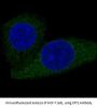 Anti-CPT2 Rabbit Monoclonal Antibody