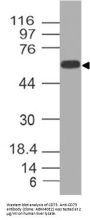 Anti-CD73 Antibody (Monoclonal, ABM40E2)