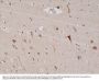 Anti-PSD-95 DLG4 Rabbit Monoclonal Antibody, Clone#RM288