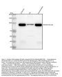 Anti-PSD95 DLG4 Rabbit Monoclonal Antibody