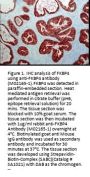 Anti-FKBP52 Monoclonal Antibody
