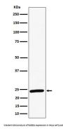 Anti-RAB8A Rabbit Monoclonal Antibody