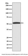 Anti-ARRB1/Beta Arrestin 1 Rabbit Monoclonal Antibody