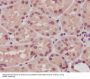 Anti-ARRB1/Beta Arrestin 1 Rabbit Monoclonal Antibody