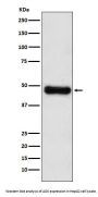 Anti-ADK Rabbit Monoclonal Antibody