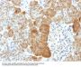 Anti-VLDL-Receptor (Very Low Density Lipoprotein Receptor) Monoclonal Antibody