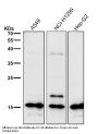 Anti-Uteroglobin SCGB1A1 Monoclonal Antibody