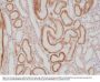 Anti-p504s/AMACR Rabbit Monoclonal Antibody, Clone#RM349