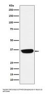 Anti-PHOX2B Monoclonal Antibody
