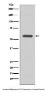 Anti-STK3/Mst2 Rabbit Monoclonal Antibody