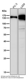 Anti-Collagen VI COL6A1 Rabbit Monoclonal Antibody
