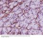 Anti-Collagen VI COL6A1 Rabbit Monoclonal Antibody
