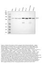 Anti-HIP1 Monoclonal Antibody