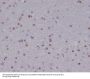 Anti-Olig2 Rabbit Monoclonal Antibody