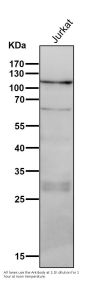 Anti-PI 3 Kinase p110 delta PIK3CD Rabbit Monoclonal Antibody