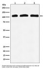 Anti-PI 3 Kinase p110 delta PIK3CD Rabbit Monoclonal Antibody