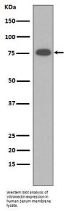 Anti-Vitronectin VTN Rabbit Monoclonal Antibody