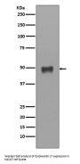 Anti-Cytokeratin 17 Rabbit Monoclonal Antibody
