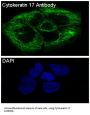 Anti-Cytokeratin 17 Rabbit Monoclonal Antibody