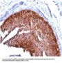 Anti-Cytokeratin 17 (KRT17) (Basal Epithelial Marker) Monoclonal Antibody