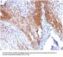 Anti-Cytokeratin 17 (KRT17) (Basal Epithelial Marker) Monoclonal Antibody