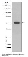 Anti-Cytokeratin 10 KRT10 Rabbit Monoclonal Antibody