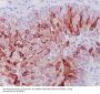 Anti-Cytokeratin 10 KRT10 Rabbit Monoclonal Antibody