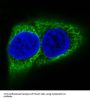 Anti-Cytokeratin 10 KRT10 Rabbit Monoclonal Antibody