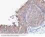Anti-Cytokeratin 10 (Suprabasal Epithelial Marker) Monoclonal Antibody