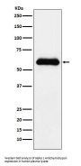 Anti-alpha 1 Antichymotrypsin SERPINA3 Monoclonal Antibody