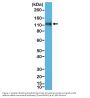 Anti-p120-catenin Rabbit Monoclonal Antibody, Clone#RM353