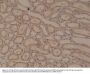 Anti-p120-catenin Rabbit Monoclonal Antibody, Clone#RM353