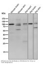 Anti-delta 1 Catenin/p120 Catenin Rabbit Monoclonal Antibody