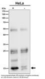 Anti-VAMP8/Endobrevin Rabbit Monoclonal Antibody