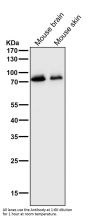 Anti-MEKK2 MAP3K2 Rabbit Monoclonal Antibody
