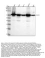 Anti-IMP3 IGF2BP3 Monoclonal Antibody