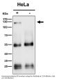 Anti-ATP citrate lyase ACLY Rabbit Monoclonal Antibody