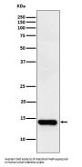 Anti-FABPI Rabbit Monoclonal Antibody