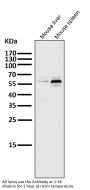 Anti-PFKFB3 Monoclonal Antibody