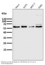Anti-PFKFB3 Monoclonal Antibody
