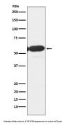 Anti-PFKFB3 Monoclonal Antibody