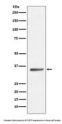 Anti-SIRT5/Sirtuin 5 Rabbit Monoclonal Antibody